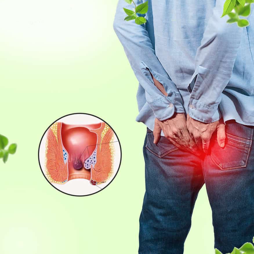 Piles Treatment With in 10 Days By Charsootra Technic